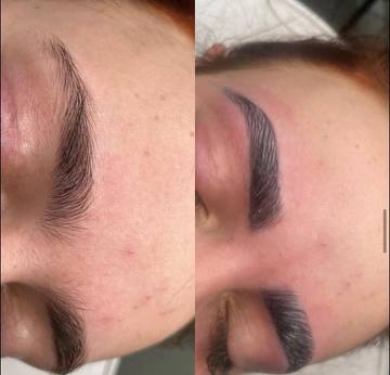 Eyebrow treatment 1